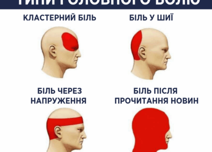 Про типи головного болю