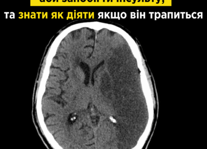 Як запобігти інсульту та що робити, якщо він трапиться