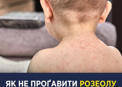 Як не проґавити розеолу